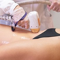 Depilação-a-Laser